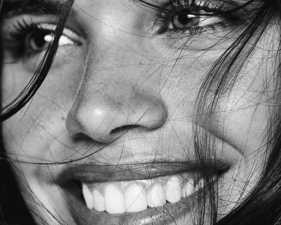 Bright white smile after professional teeth whitening