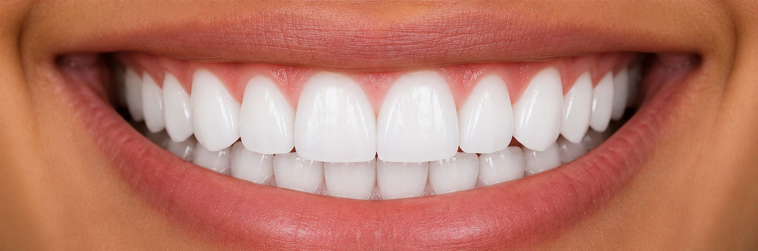 After — 8 shades whiter post Philips Zoom