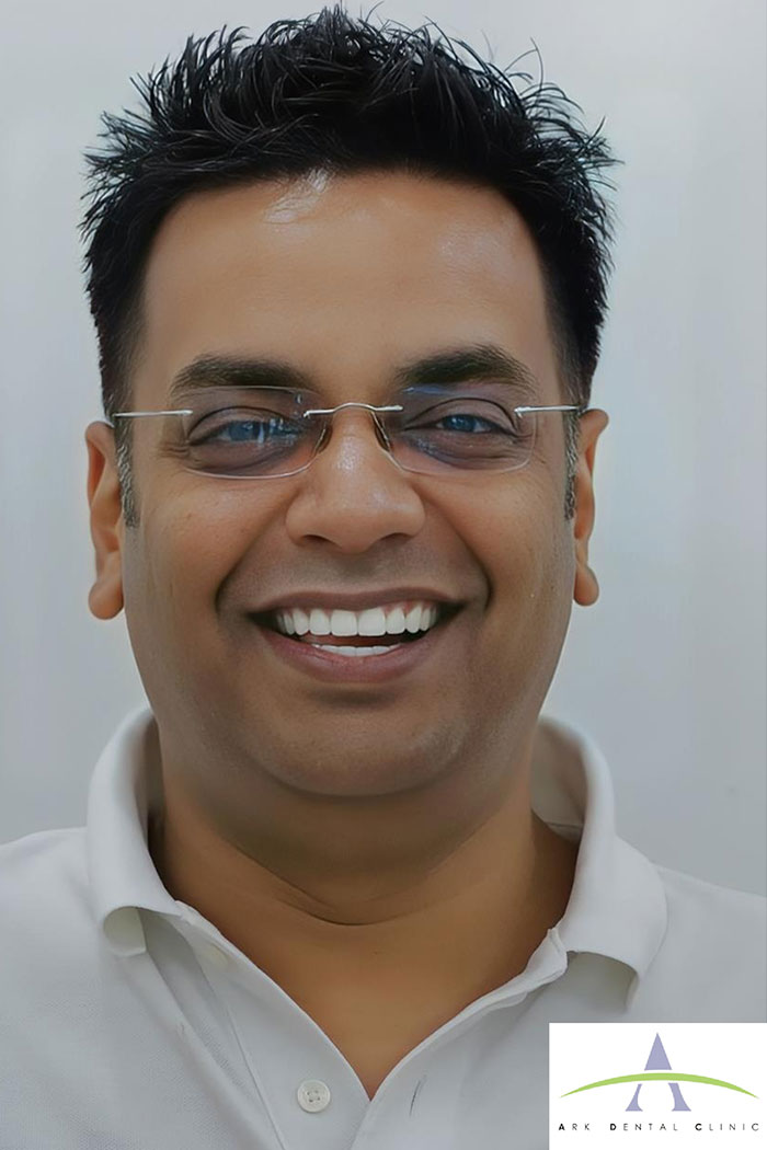 After E-max porcelain veneers — Hollywood smile