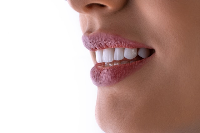 Cosmetic dentistry and smile design at Ark Dental Global, GK-1 Delhi